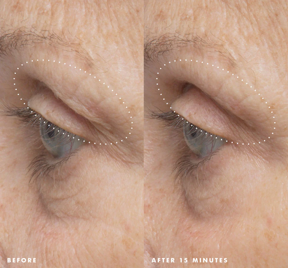 Firm-Tastic® Eyes Intensive Concentrate