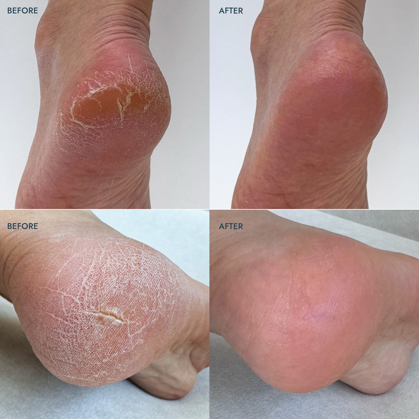SoleMate Heel Repair Balm Lavender