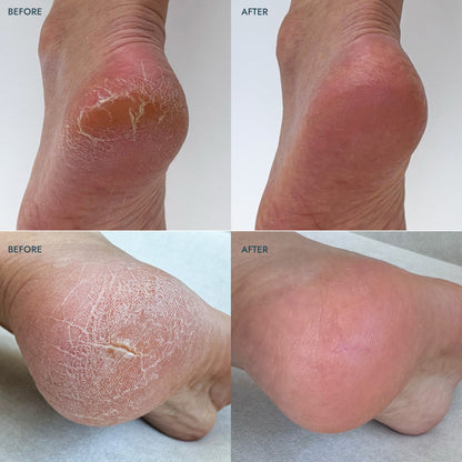 SoleMate Heel Repair Balm Lavender